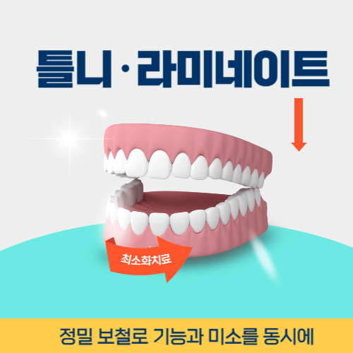 구미치과 구미시 치과 틀니 라미네이트