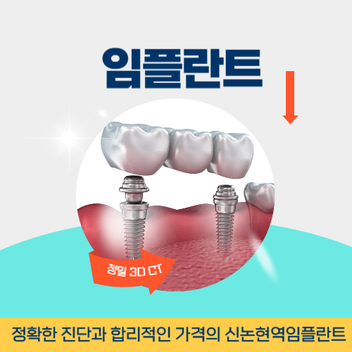 구미치과 구미시 치과 임플란트