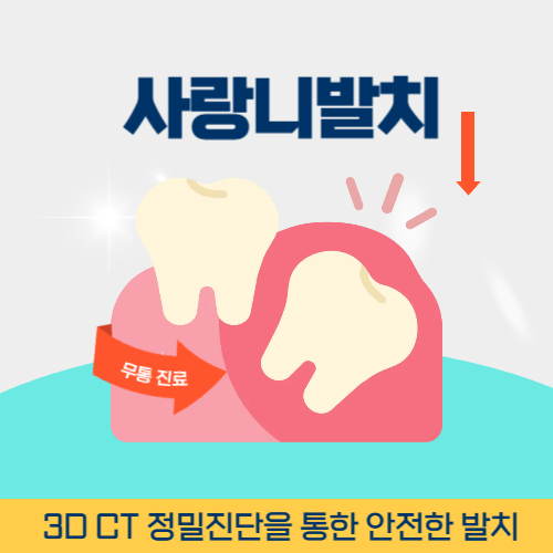 구미치과 구미시 치과 사랑니 발치