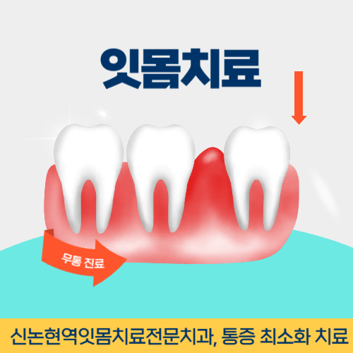 구미치과 구미시 치과 잇몸치료